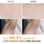 Dr.Melaxin Peel Shot Exfoliating Kojic Acid Turmeric Spray 200ml